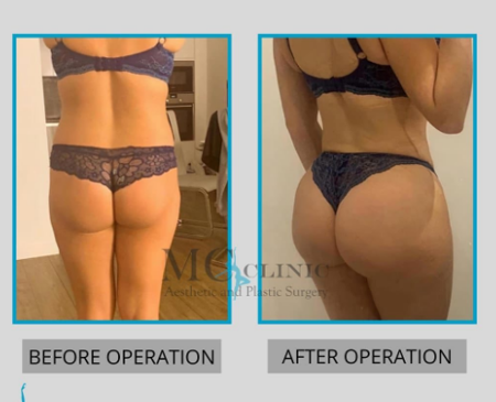 Slider image (2) MEHMET CEBER CLINIC